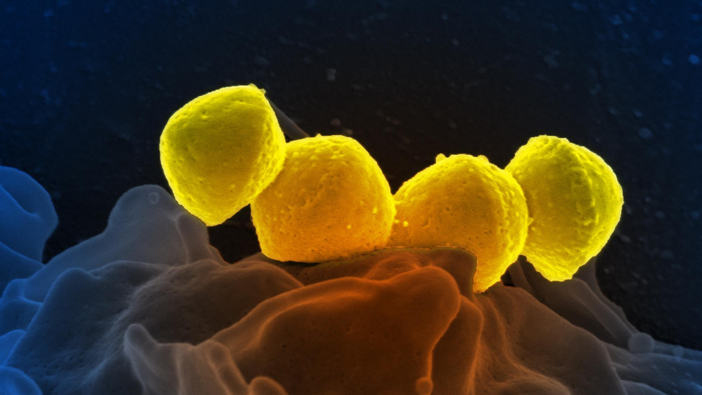 Streptococcus pyogenes on a human neutrophil cell (image CC BY-SA 2.0 NIAID)